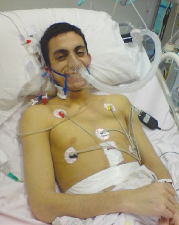 David, age 29, the day after his liver transplant at Kings College Hospital in 2009